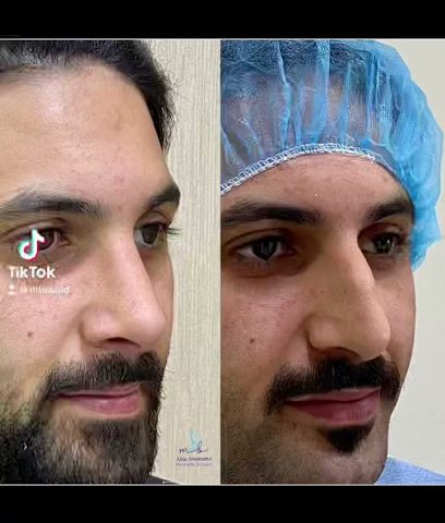 دكتور مصطفى بوزيد - صباح السالم - +965 550 00241